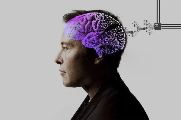 Neuralink
