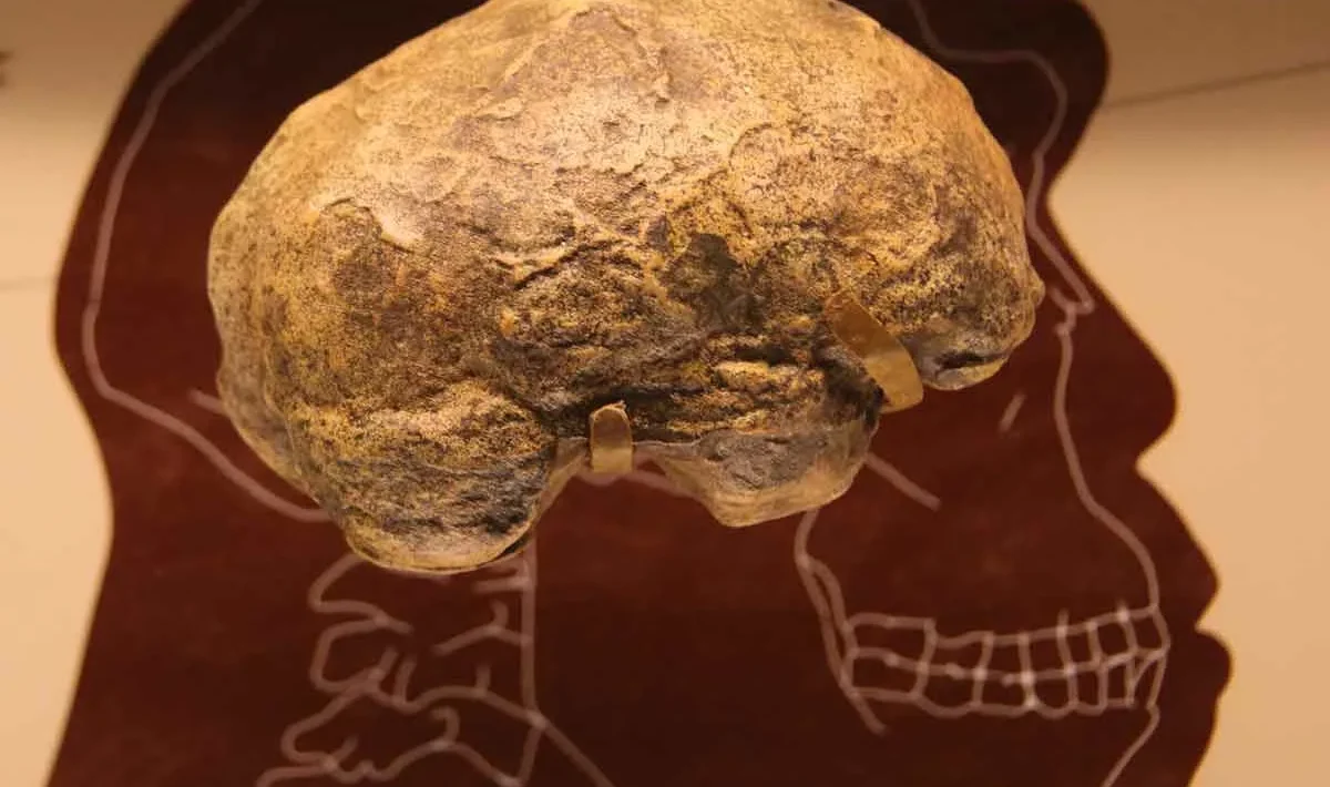craniu