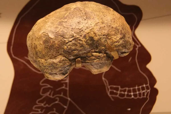 craniu